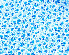 Extra Light Linen Floral Pattern Sleeve Arm Protectors 37 cm x 17 cm - Pack of 2 Pairs, Fine Blue Floral Design